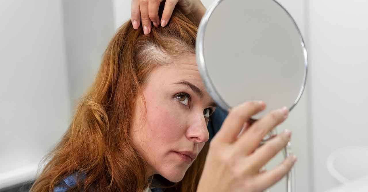 Alopecia areata.Causes of Hair Loss hair fall sol cause of hair fall
