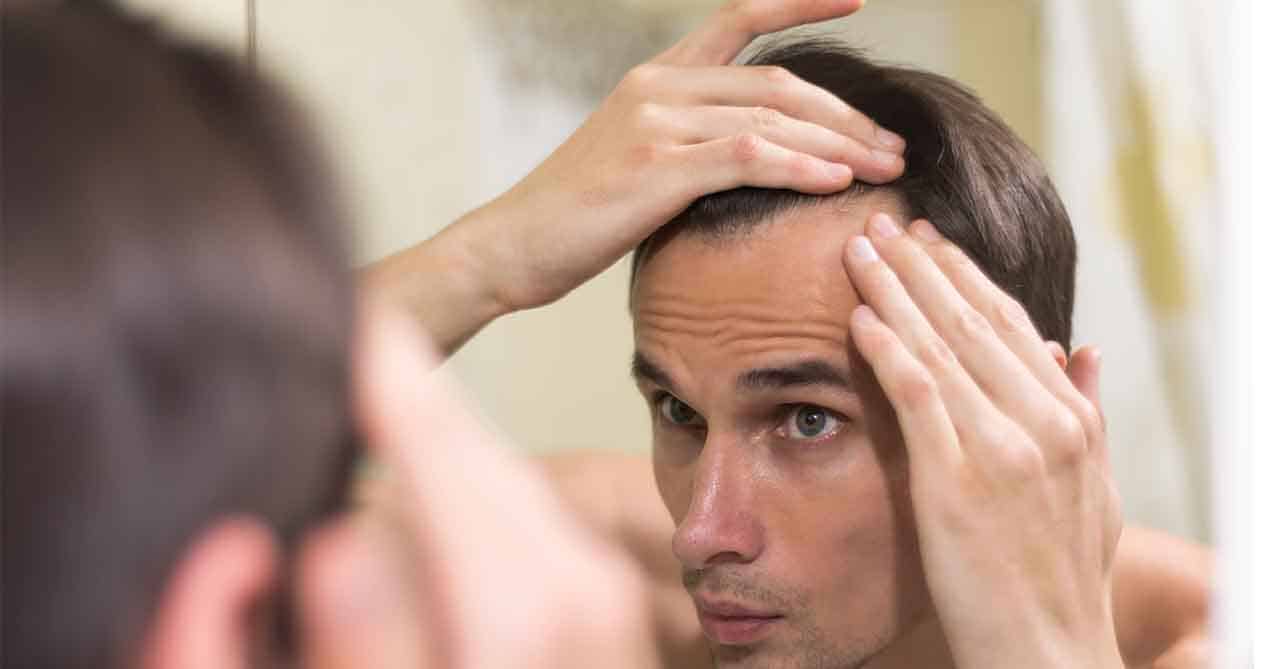Traction Alopecia .Causes of Hair Loss hair fall sol cause of hair fall
